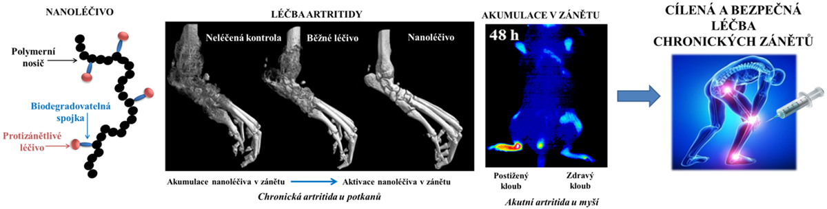 Polymerní materiály pro léčbu chronických zánětlivých onemocnění